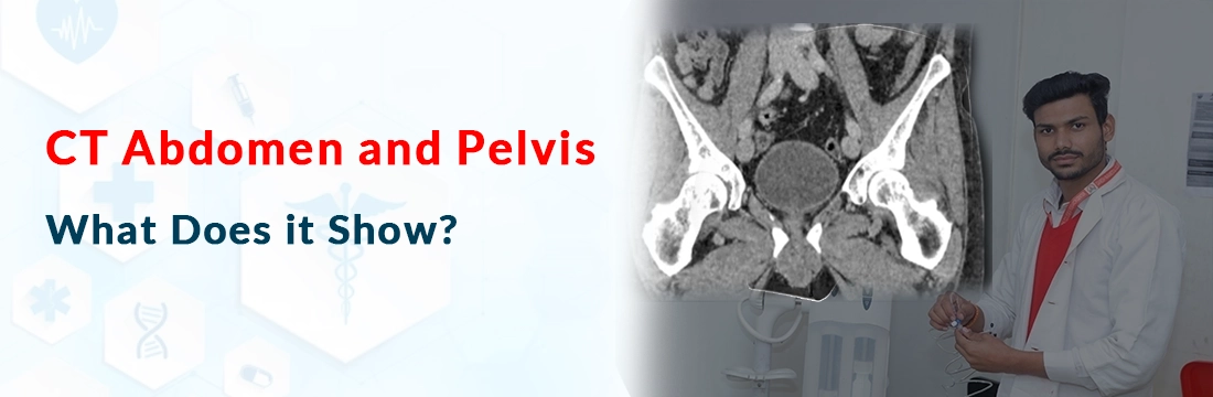  CT Abdomen and Pelvis: What Does it Show?